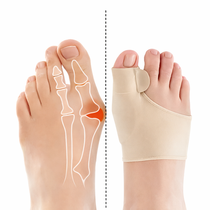 BunionCare Pro™ – Corrector Ortopédico de Juanetes con Gel Anatómico